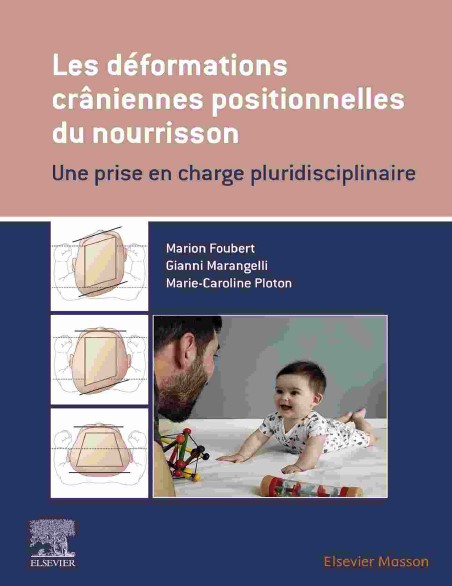 Les déformations crâniennes positionnelles du nourrisson