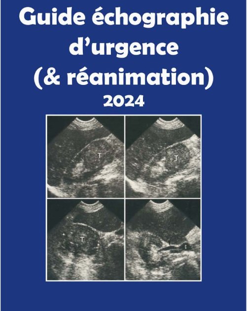 Guide échographie d'urgence (& réanimation) 2024