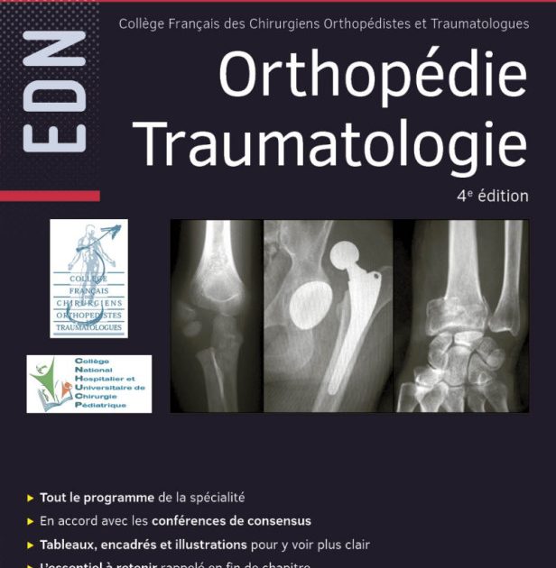 Collège Orthopédie Traumatologie - R2C / ECNI / EDN Référentiel des collèges - 4ème édition